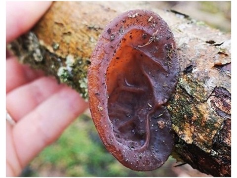 Вальгусная косточка большого пальца