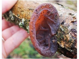 Вальгусная косточка большого пальца